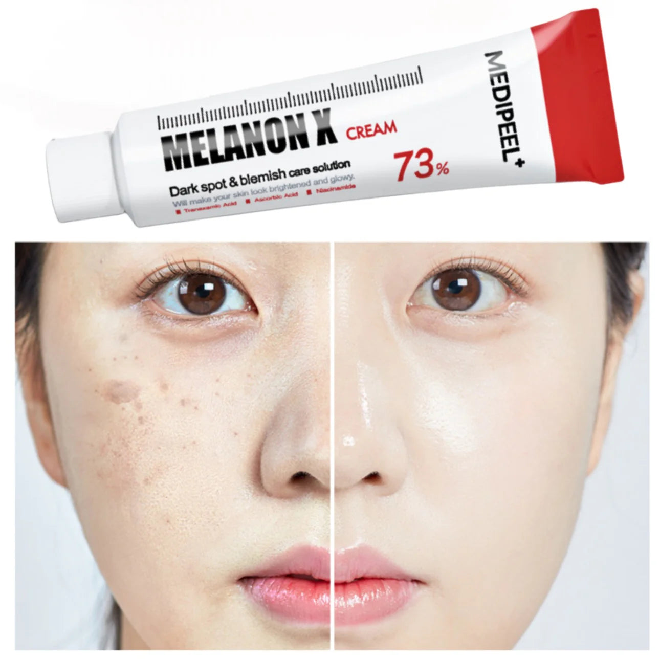 Whitening Melanon X Cream 30ml